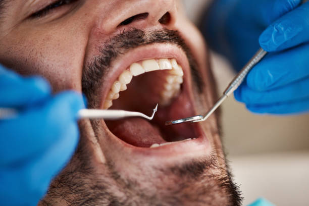 Best Emergency Tooth Extraction  in Guymon, OK